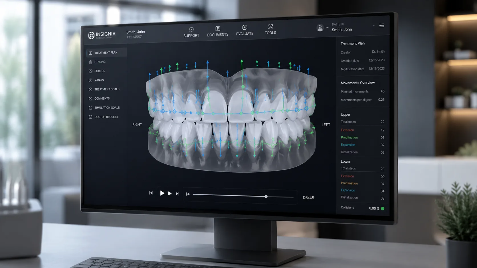 Interface do software ClinCheck mostrando planejamento ortodôntico em 3D